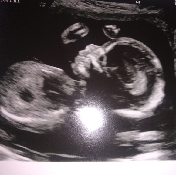 Meet your seller :) - Picture 4 of 4